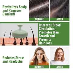 MOMISY Scalp Massager Shampoo Brush, Eco-Friendly Wheat Straw Body With Soft Silicon Bristles, Hair Scalp Scrubber, Scalp Exfoliator | Dandruff Removal, Prevents Hair Loss For Men, Women (Green)